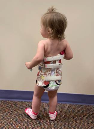 Little girl in Rigo Cheneau 3D brace from behind