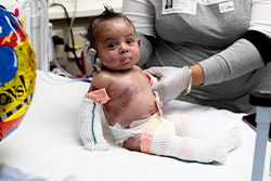 Baby Jaciel being attended to by his mother at Children's Mercy.