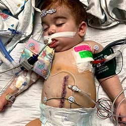 A toddler boy in a hospital bed with medical equipment after surgery.