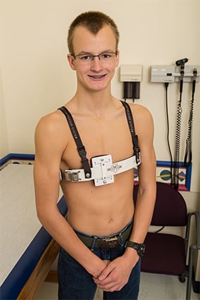 Weston Marshall smiling while wearing a pectus brace around his bare chest.