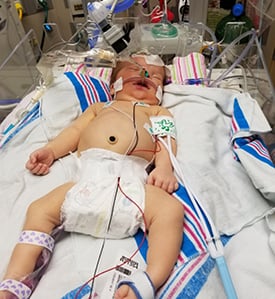Emersyn Gross at Children's Mercy with many tubes to help her breathe.