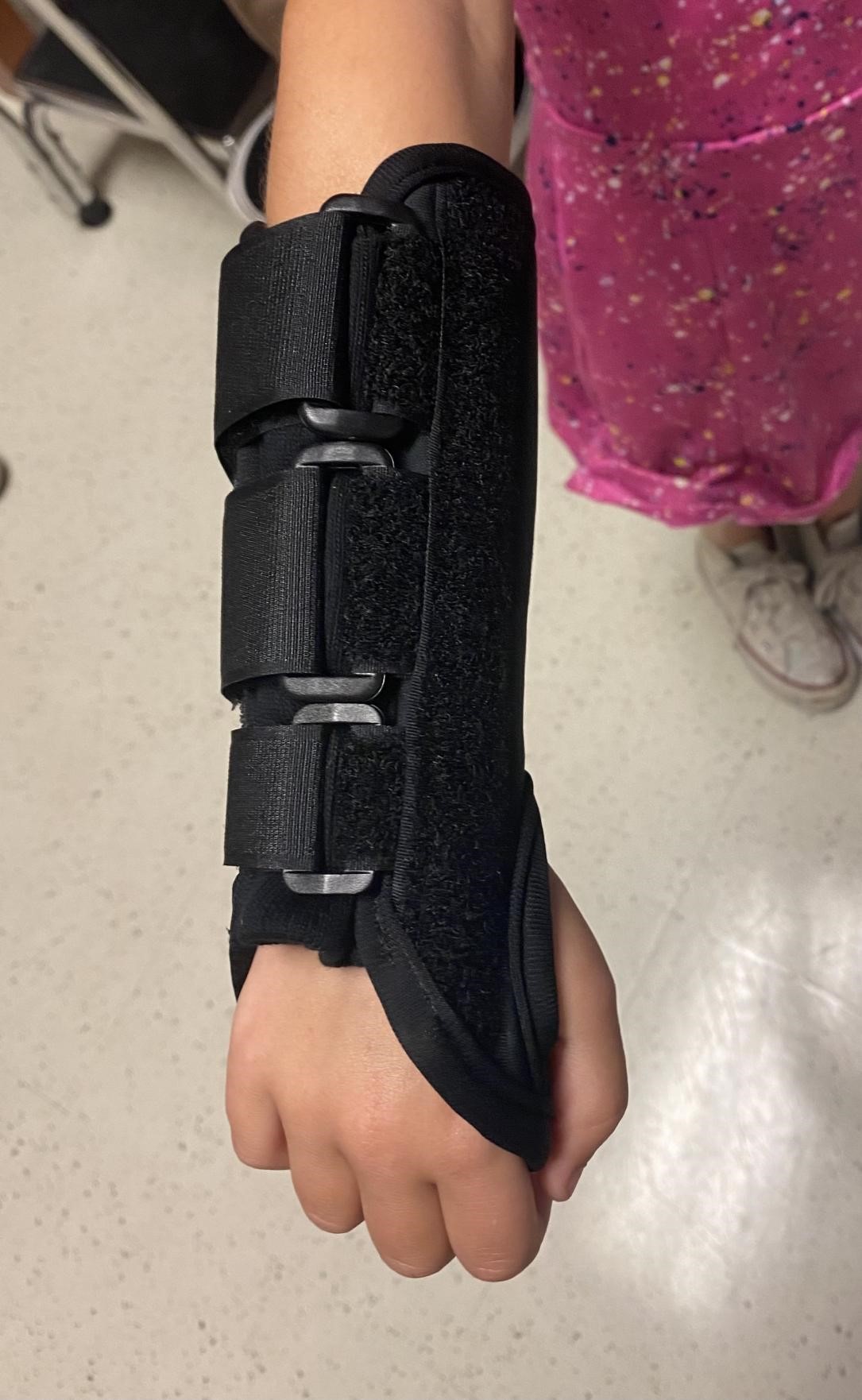 State Of The Art Pediatrics Buckle Fractures In Children Children s State Of The Art Pediatrics Buckle Fractures In Children Children s