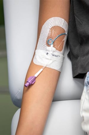 A clean and secure PICC line in a Children's Mercy patient's arm.