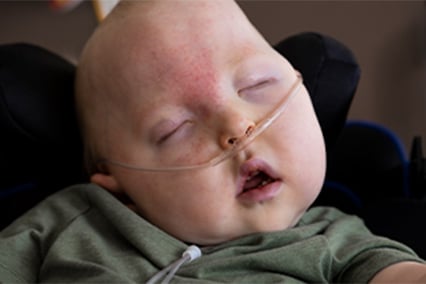 Odin Buser sleeping while wearing a nasal cannula.