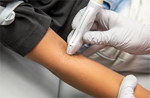 Gloved hands holding a hand-held camera against a patient's arm.