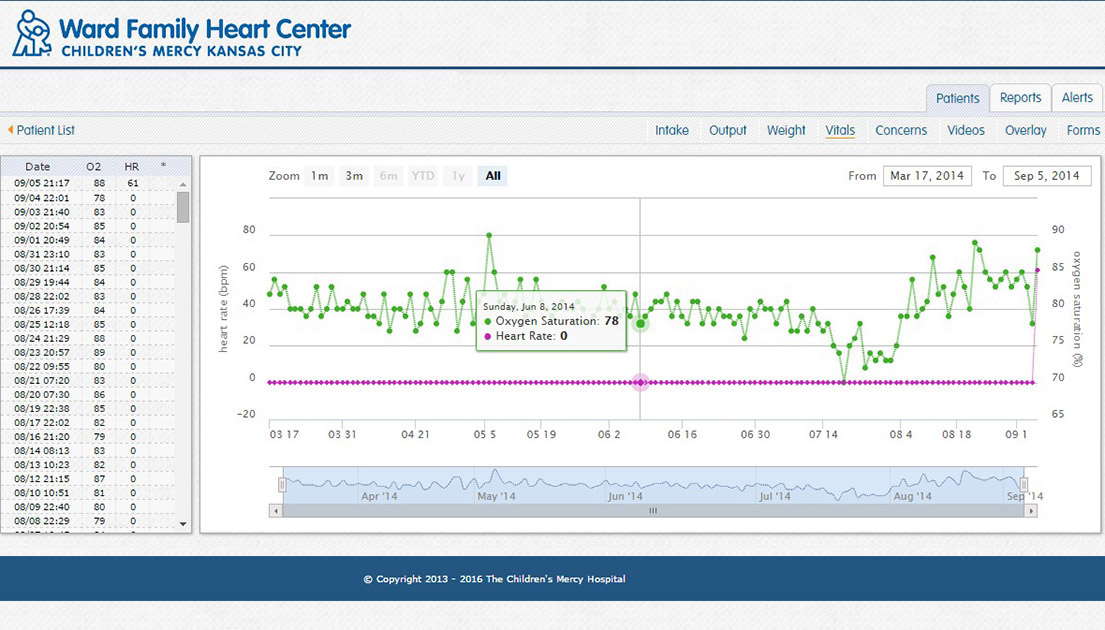 CHAMP App transits information about patient's vitals.