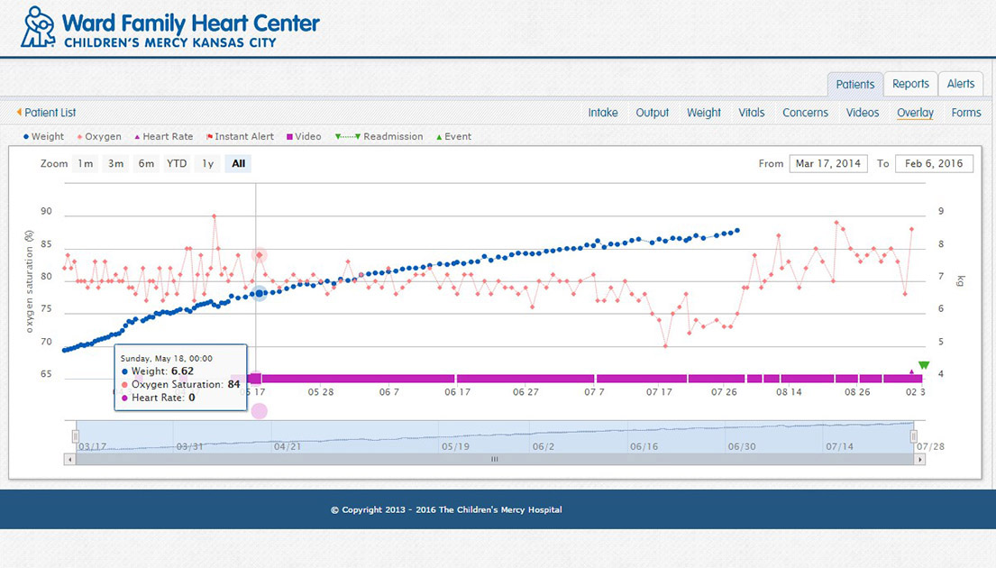 CHAMP app displays a graph about Patient's overlay.