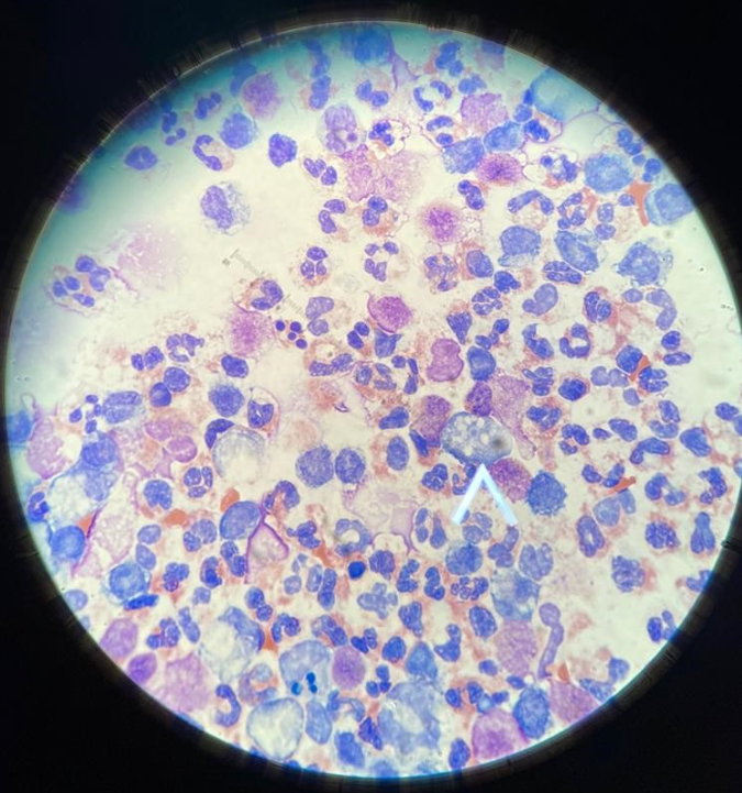 Wright stain of CSF