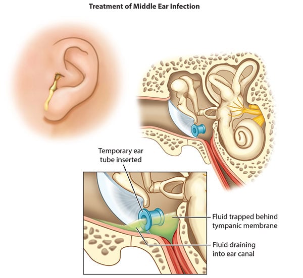 How to Safely Clean Your Child's Ears