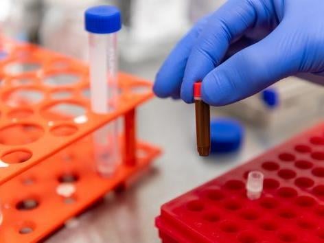 Close-up of a gloved hand placing a small blood sample tube into a red laboratory test tube rack, with additional sample tubes and racks visible in the background.