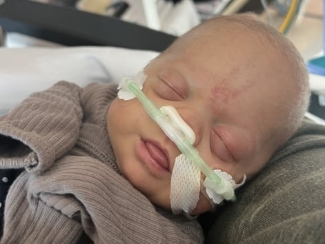 A newborn baby with a nasal cannula for oxygen support sleeps on a green pillow.
