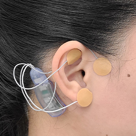 The auricular neurostimulator device attached to a person's head, behind their ear.