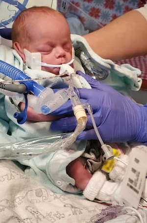A premature infant receiving respiratory support rests while being held in an upright position by a clinician wearing protective gloves.
