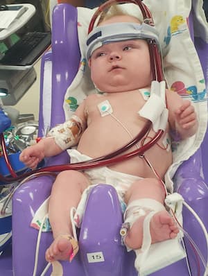A child sits in a supportive chair receiving ECMO support, with visible tubing, monitoring leads and medical dressings.