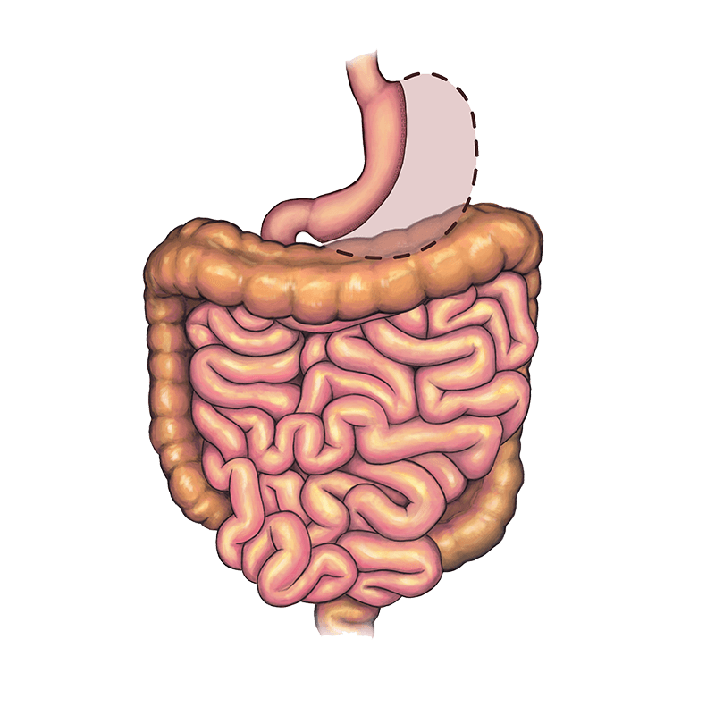 Stomach after surgery in the Surgical Weight Loss Program.