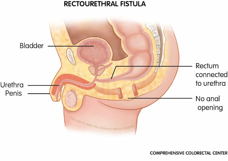 Anal Opening