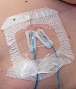 close up of a double port accessed.